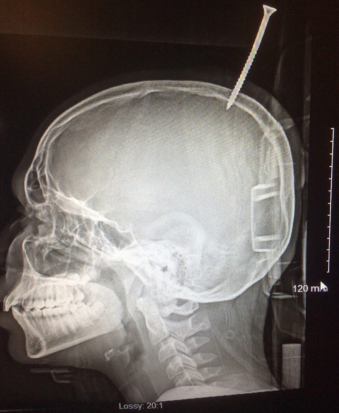 724 screw brain boy 2