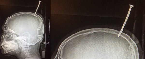 13-year-old was a "millimetre away" from death after huge screw pierced his brain