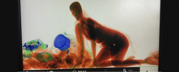 The bizarre story of how this woman ended up in an X-ray machine