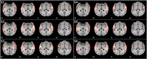 Computers can now tell what songs you've listened to just by using brain scans