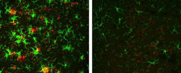 Alzheimer's has been reversed in mice with this single enzyme treatment