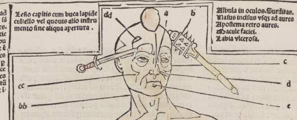 This rare book shows how insane medicine really was in the 16th century