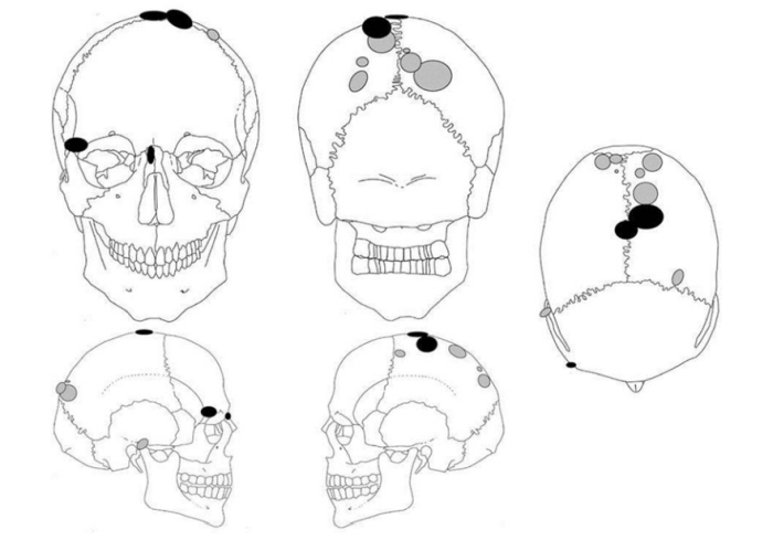 skulltraumamarkings
