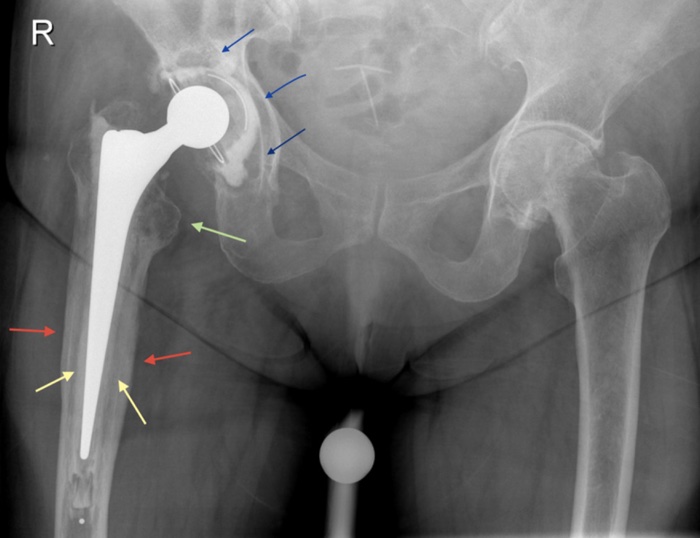 012 dog scratch hip replacement 1x