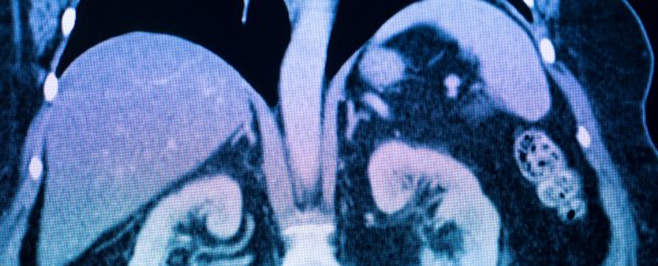 Scientists just identified a brand-new human organ. Here's what it means