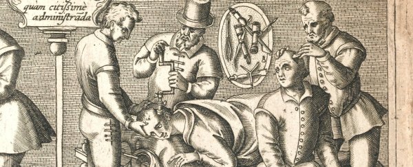 Here's why drilling holes in your skull was never really a migraine cure