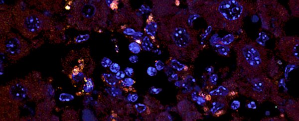 Study shows gut bacteria can spread to other organs and trigger disease