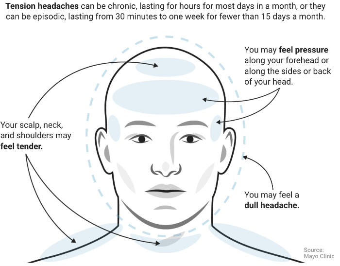 TensionHead