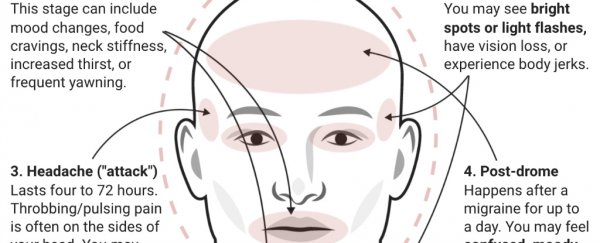 Here's how to tell the difference between a headache and a migraine