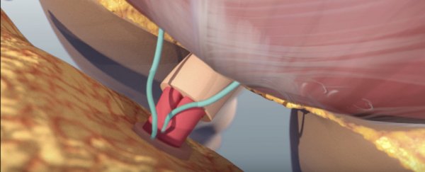 Doctors have performed the world's first full penis and scrotum transplant
