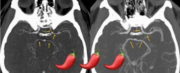 After eating a Carolina Reaper, a man ended up in hospital for an unexpected reason