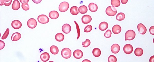 A huge gene discovery is set to improve the lives of people with blood disorders