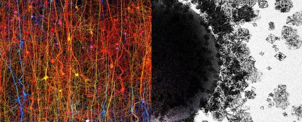 Scientists find evidence the human brain can create structures in up to 11 dimensions