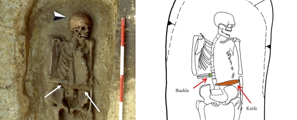 This medieval Italian man replaced his amputated hand with a knife