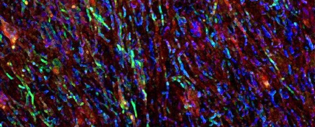 Human brain tissue, astrocytes in blue (Jorge Ivan Alvarez/University of Pennsylvania)