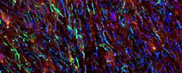 The link between gut bacteria and brain could influence multiple sclerosis