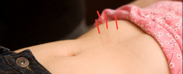 Acupuncture will not increase your chances of pregnancy on IVF, study shows