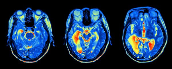 There's no such thing as being right or left-brained, and 9 other brain myths we've all heard