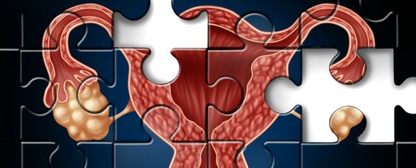 We might finally know the cause of polycystic ovary syndrome