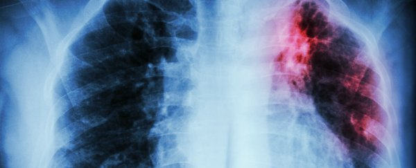 Scientists just found an unexpected link between tuberculosis and Parkinson's disease