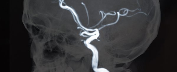 New evidence hints at a worrying link between brain cholesterol and Alzheimer's