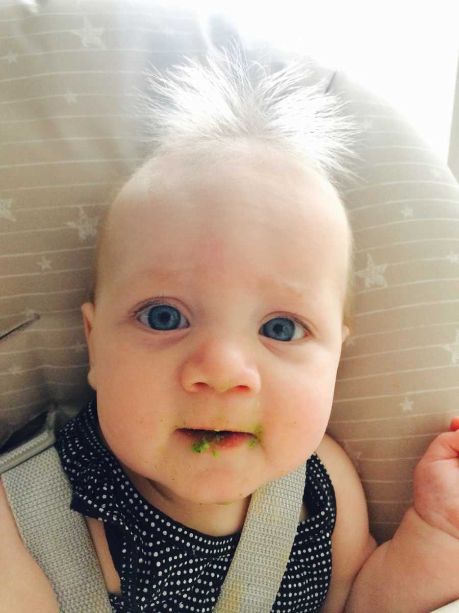 This Adorable Toddler Has 'Uncombable Hair Syndrome', And It's a Rare Genetic Quirk : ScienceAlert This Adorable Toddler Has 'Uncombable Hair Syndrome', And It's a Rare Genetic Quirk : ScienceAlert