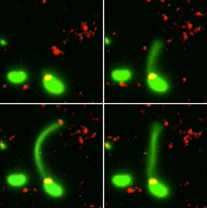 Arpón de bacterias todavía