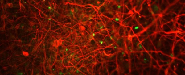 We may have been wrong about what kills brain cells in Alzheimer's disease