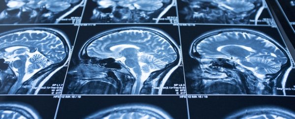 Scientists just discovered how water gets from blood into the brain