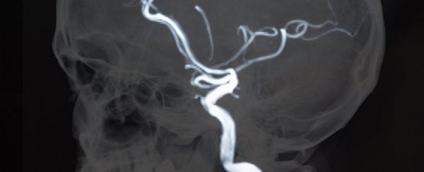 Herpes has been linked to Alzheimer's, reigniting a controversial hypothesis about the disease