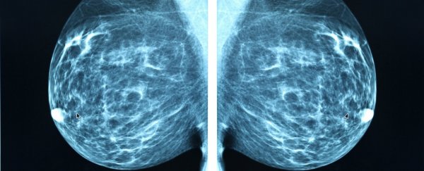 Many patients with breast cancer don't actually need chemo, study finds