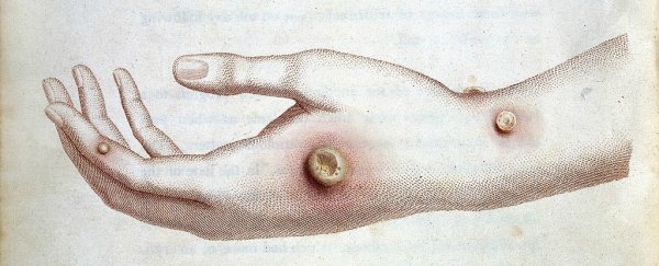 A UK teen has caught a disease that hasn't been common since the 18th century