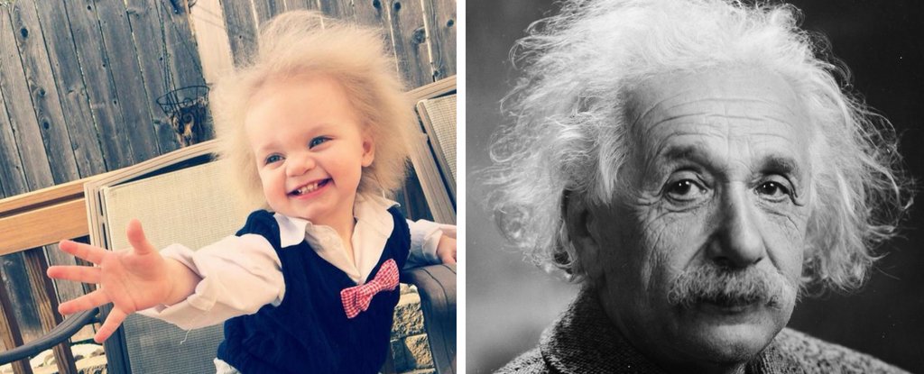 This Adorable Toddler Has 'Uncombable Hair Syndrome', And It's a Rare  Genetic Quirk : ScienceAlert