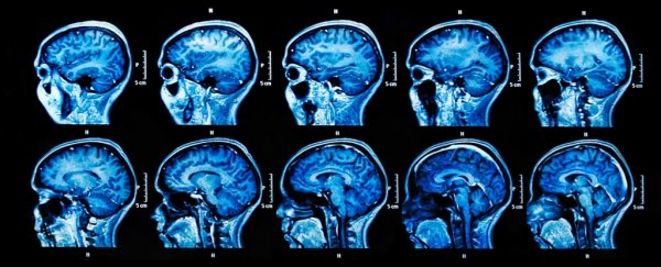 Female brains appear to be more youthful than male ones, study suggests