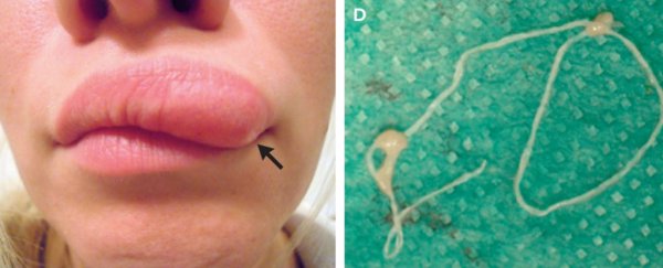 A moving lump in a woman's face turned out to be the grossest thing you could imagine