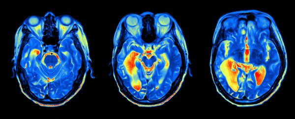 Feeling younger than your age could be a good sign for your brain health, scans suggest