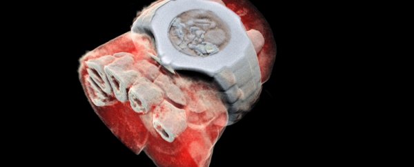 Whoa, we now have X-rays that take colour images of the human body
