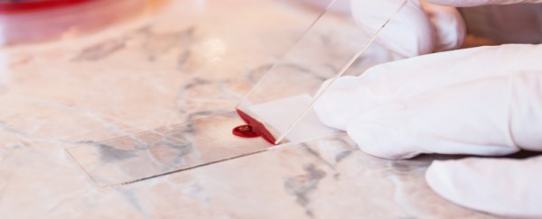 This new blood test can detect deadly skin cancer better than a biopsy