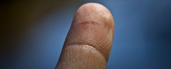 Science explains why tiny paper cuts hurt so damn much