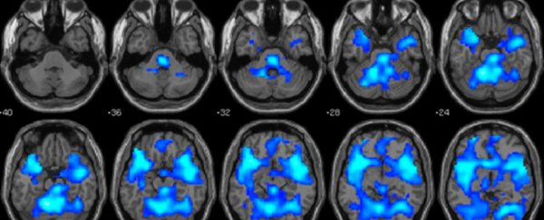 Neuroscientists have found new brain clues for what really causes psychopathy