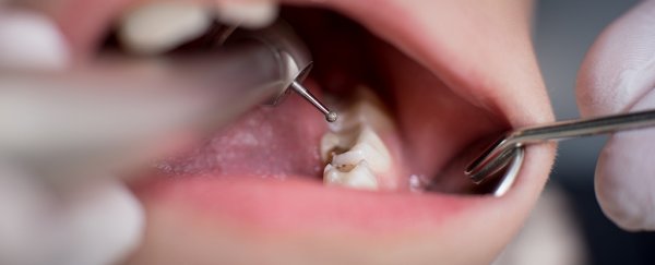 These powerful new medical devices could make mercury leak out of your dental work