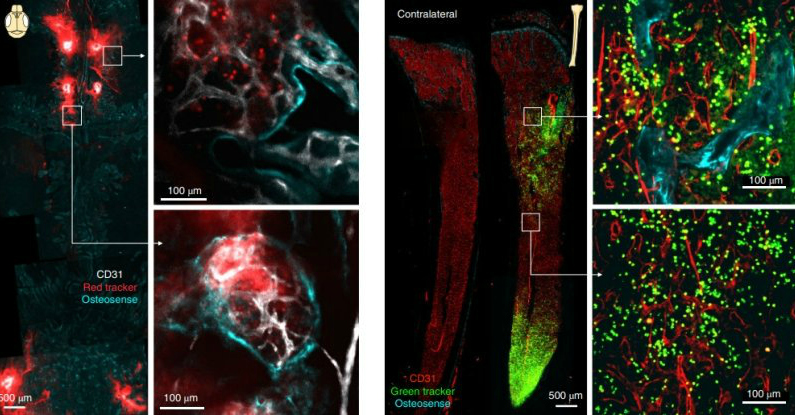 brain channels Fluorescence web