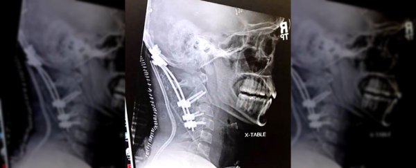 Man incredibly lucky to be alive after surviving rare and bizarre 'internal decapitation'