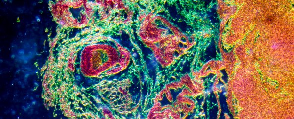 Scientists have discovered a brand new 'micro-organ' in the human immune system