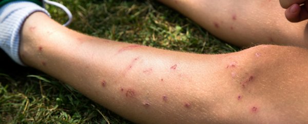 A scientist explains why mosquitoes bite some people more than others