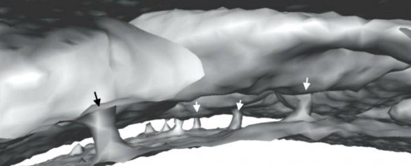 There are 'secret' tunnels connecting your skull and the brain