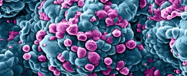 Scientists have just measured the 'speed of death' of a cell and it's surprisingly beautiful