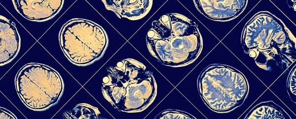 Some people seem to be immune to damaging Alzheimer plaques in the brain, and now we might know why