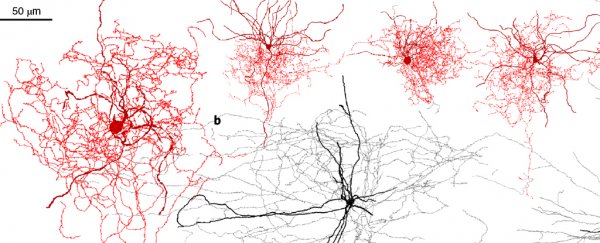 Scientists have found a new type of brain cell and it looks like it's unique to humans