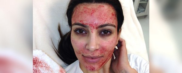 'Vampire facial' spa has been shut down over fears of blood infections